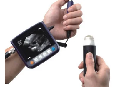 miniScan ultraljud,veterinär ultraljud skanner
