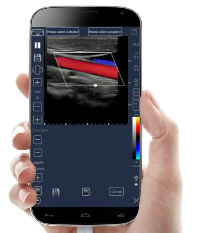 Meditech tablet ultraljud skanner, färg doppler,android doppler,iphone ultraljud skanner